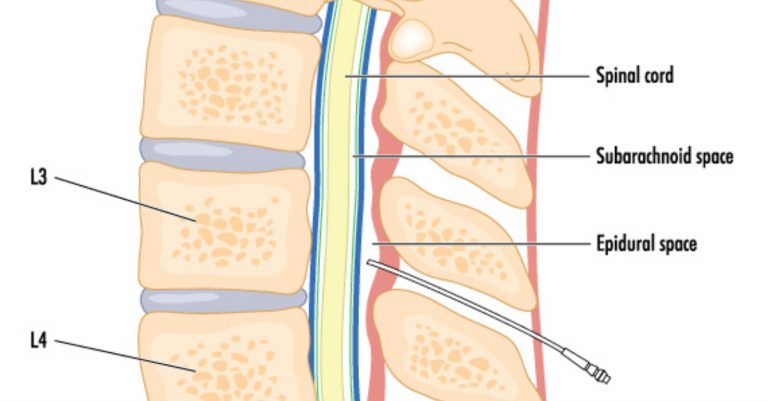 Image of spinal chord