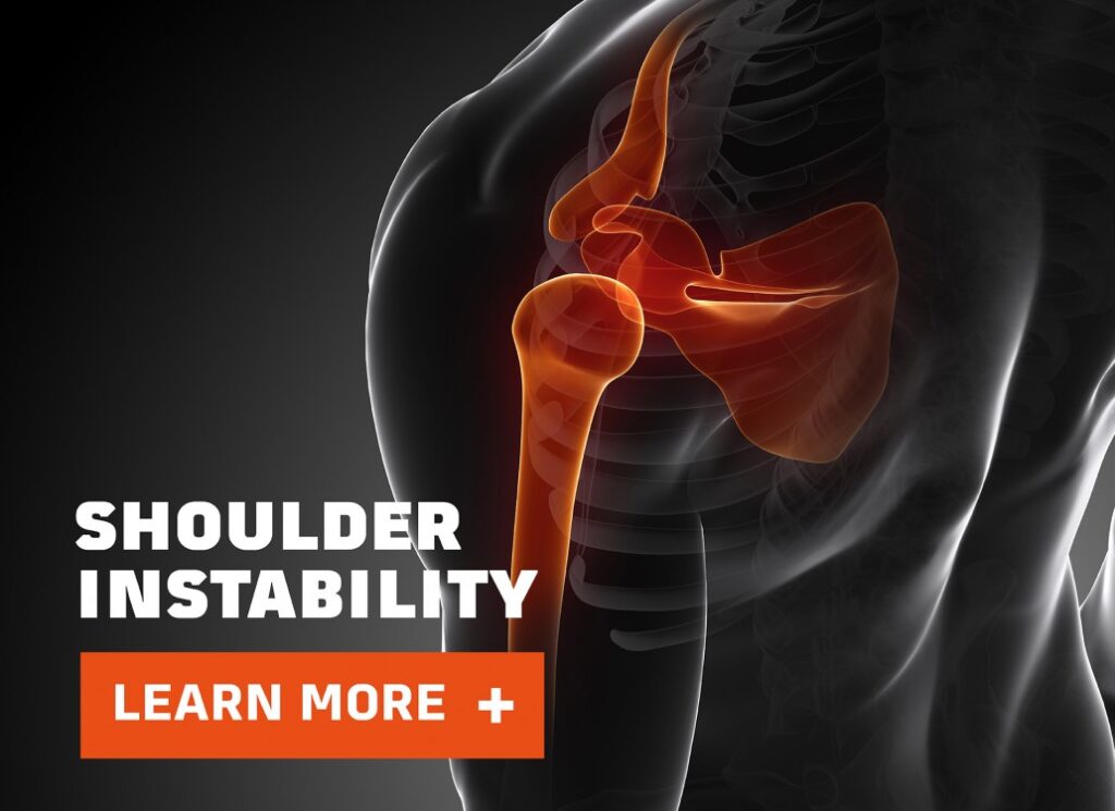 image of the shoulder instability guide